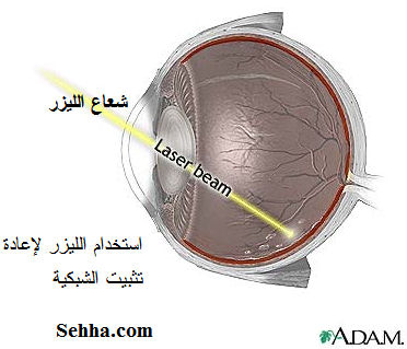 retina13.jpg